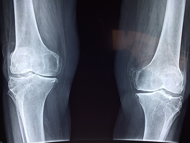 Digital Motion X-rays