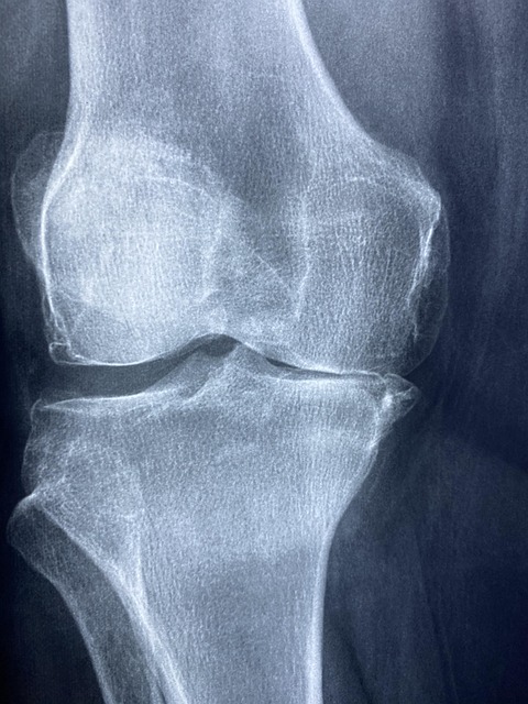Digital Motion X-rays