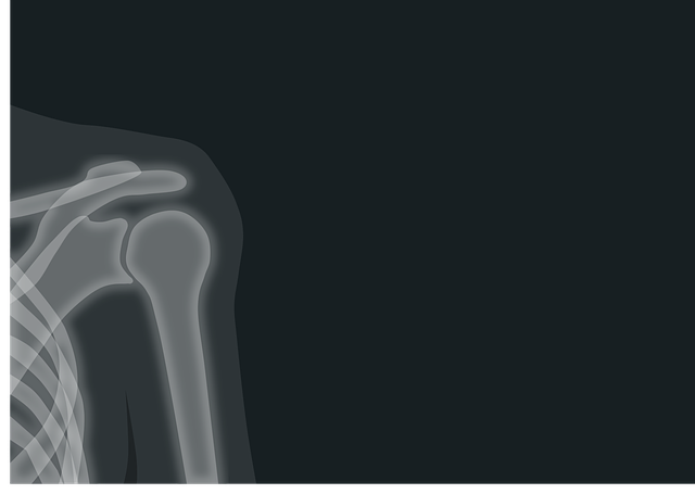 Shoulder Pain