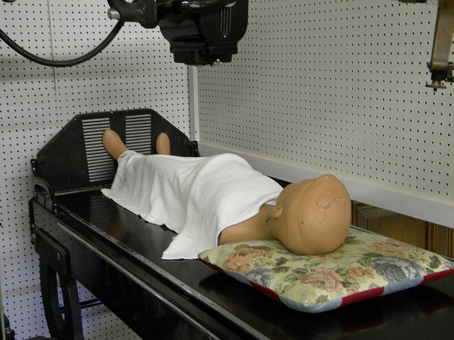 Chiropractic Care for Concussion Recovery: A Comprehensive Guide