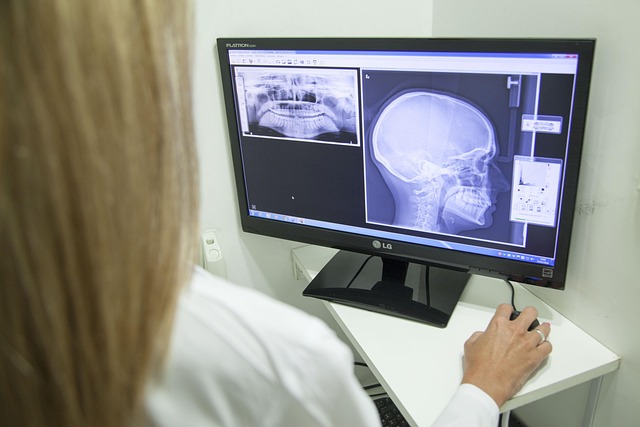 Digital Motion X-rays