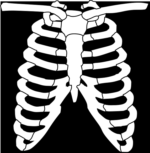 Digital Motion X-rays