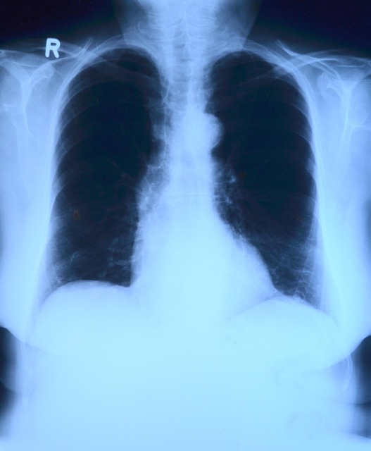 Digital Motion X-Rays: Advanced Chiropractic Care for Auto Injury Diagnosis