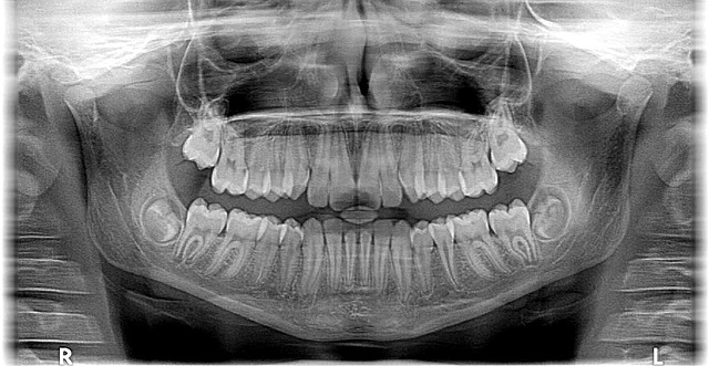 digital-motion-x-rays-640x480-91884916.jpeg