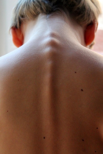 Back andNeck Spasms