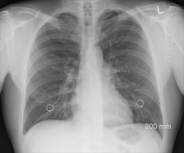 Digital Motion X-rays