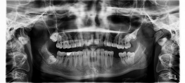 digital-motion-x-rays-640x480-5658007.jpeg