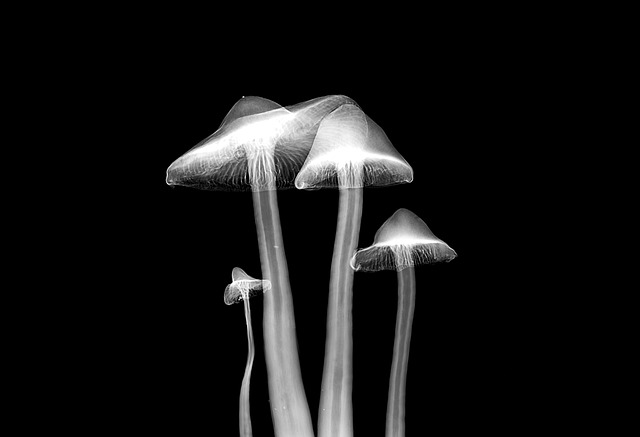 Digital Motion X-rays