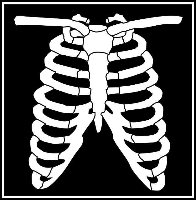 Digital Motion X-rays