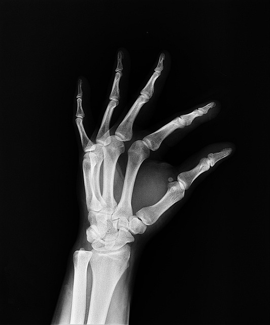Digital Motion X-rays