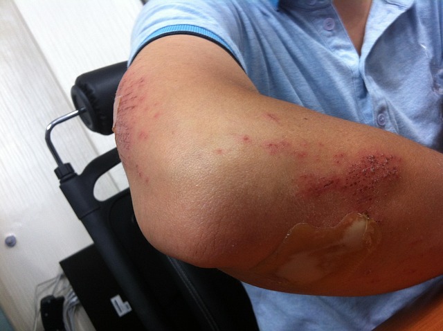 Spinal Ligament Injury Chiropractor