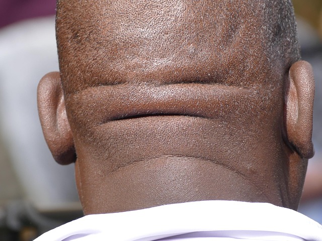 Stiff Neck