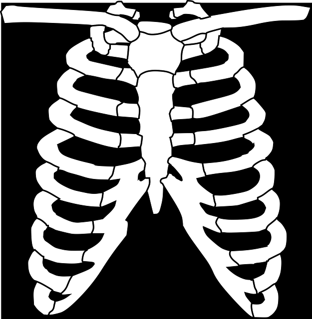 Digital Motion X-rays