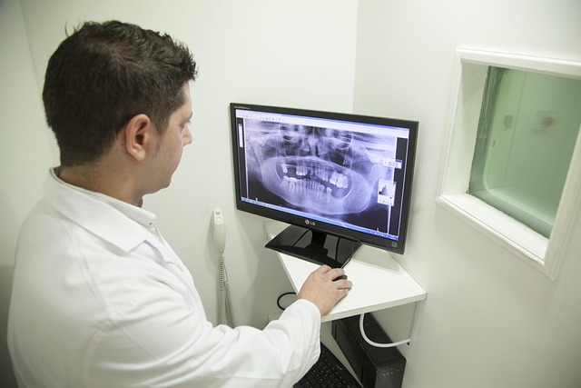 Digital Motion X-rays