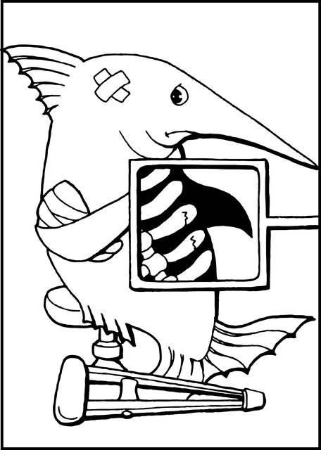 Digital Motion X-rays