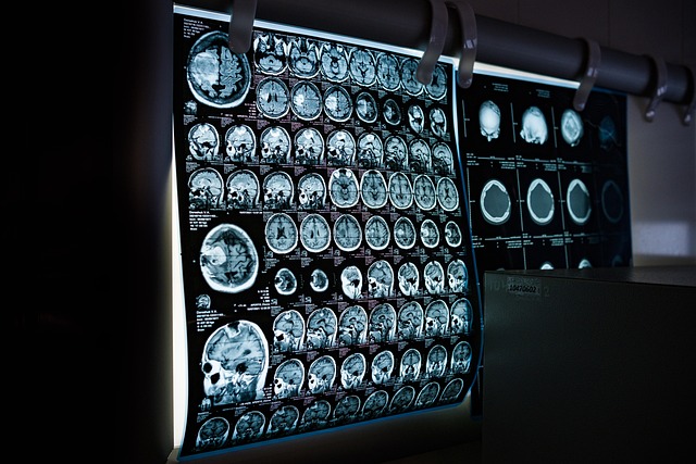 Digital Motion X-rays