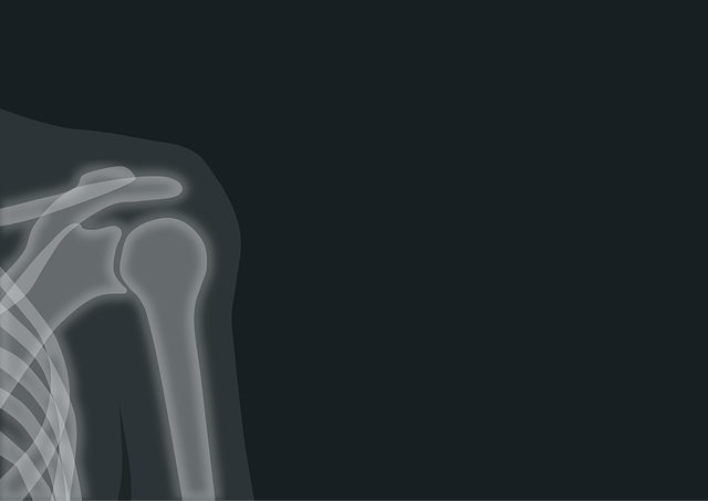 Digital Motion X-rays: Transforming Auto Injury Care Post-Accident