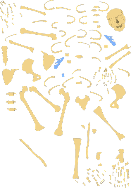 Digital Motion X-rays