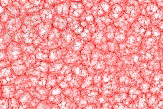 Pinched Nerves