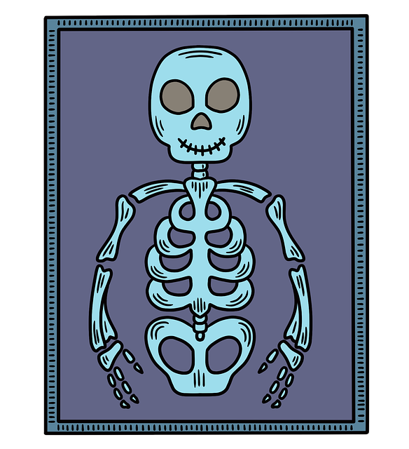 Digital Motion X-rays