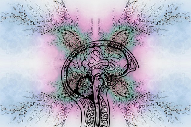 Migraine Headache