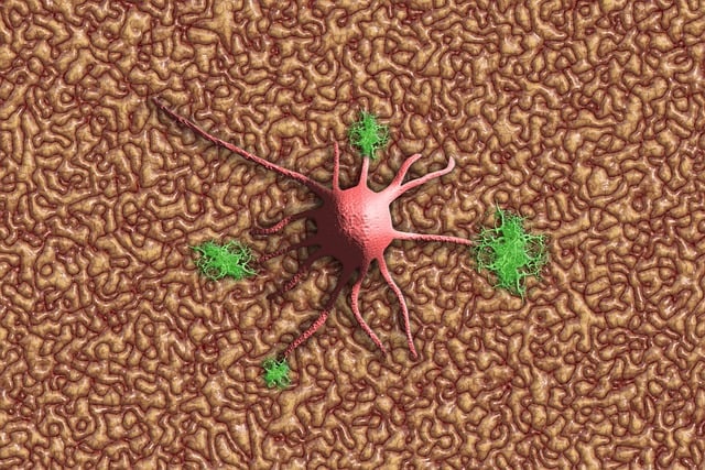 Pinched Nerves