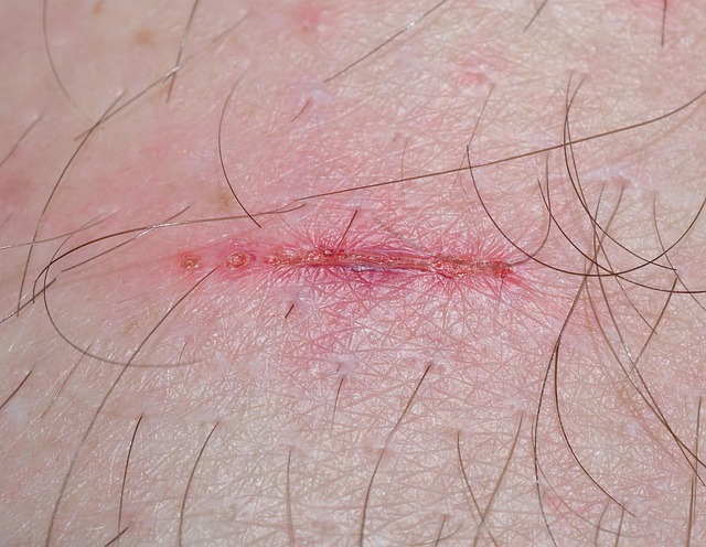 Spinal Ligament Injury Chiropractor