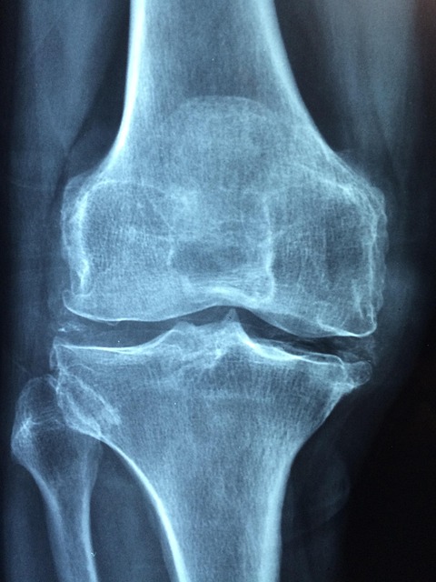 digital-motion-x-rays-640x480-16496866.jpeg