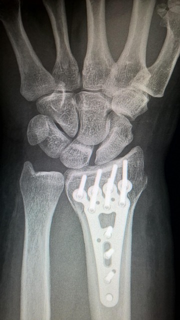 digital-motion-x-rays-640x480-39500996.jpeg