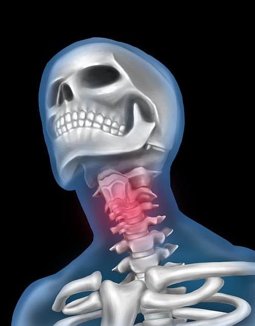 Treating Low Back Pain After Auto Accidents with Chiropractice
