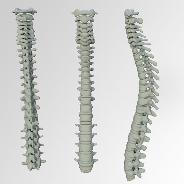 Back andNeck Spasms