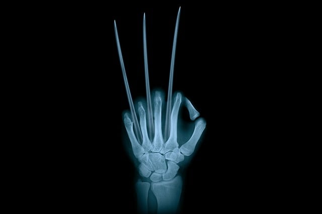 Digital Motion X-rays