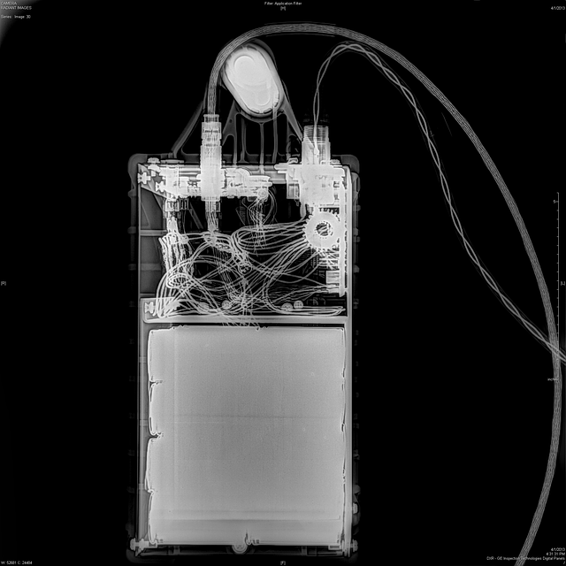 Digital Motion X-rays