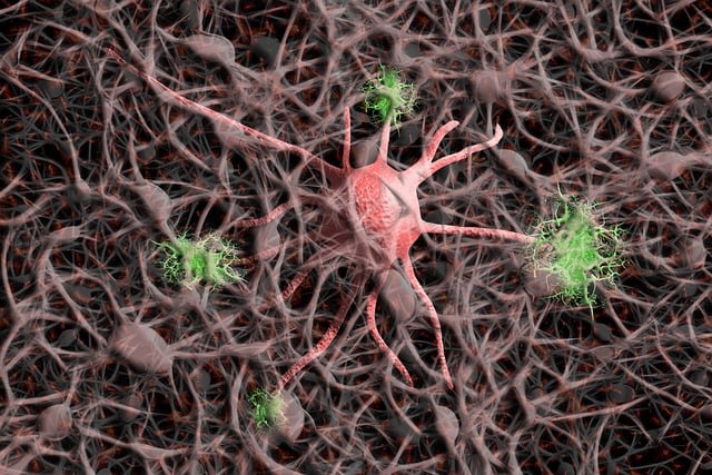Pinched Nerves