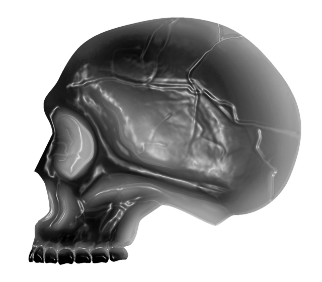 Digital Motion X-rays