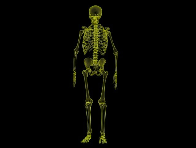Digital Motion X-rays