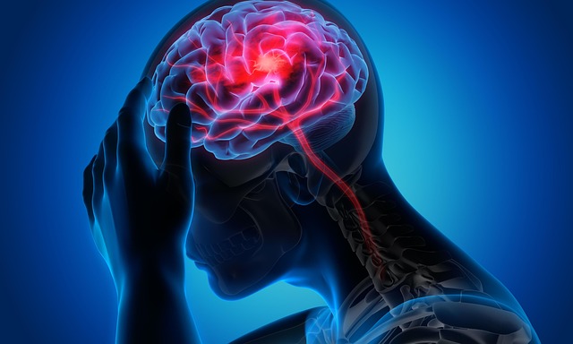 Chiropractor Relief for Auto Accident Headaches &amp; Migraines