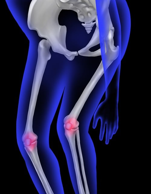 sciatic-pain-640x480-25448420.jpeg
