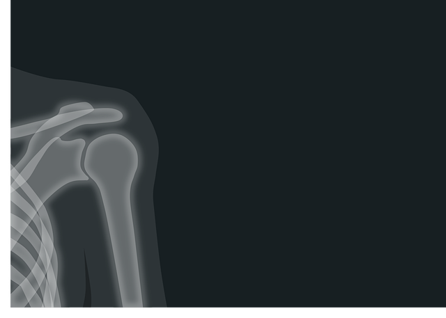 Shoulder Pain