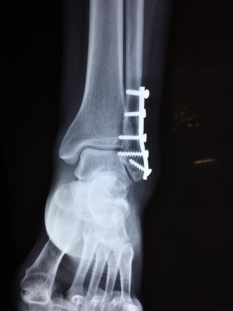 spinal-ligament-injury-chiropractor-640x480-91799709.jpeg
