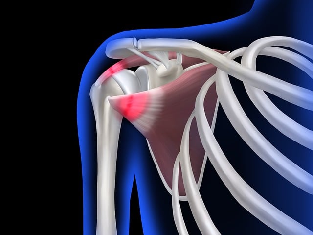 Upper Back Pain