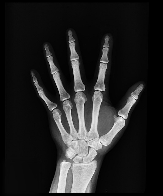Long-Term Chiropractic Care for Car Wreck Recovery