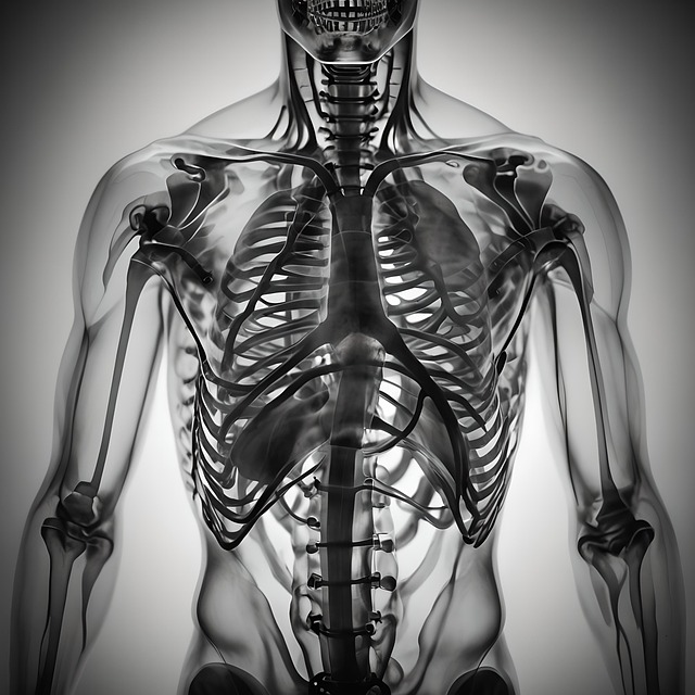 Digital Motion X-rays