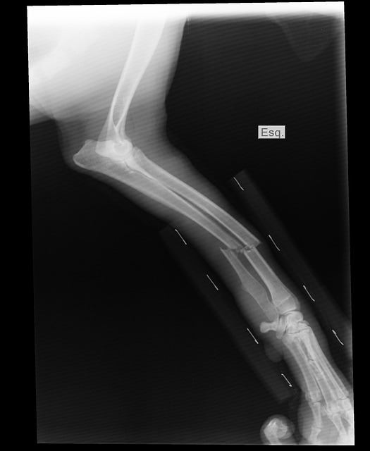 digital-motion-x-rays-640x480-23700830.jpeg