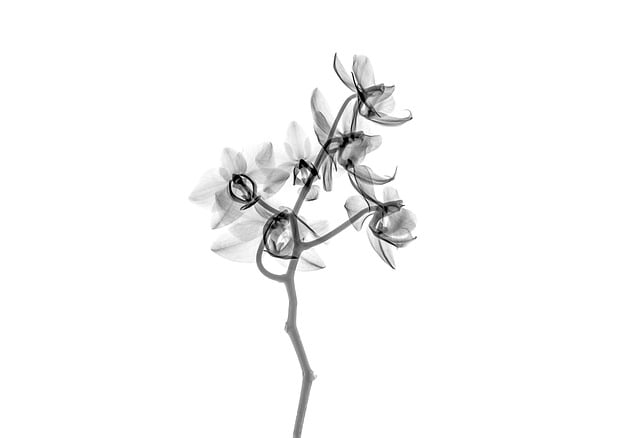 Digital Motion X-rays
