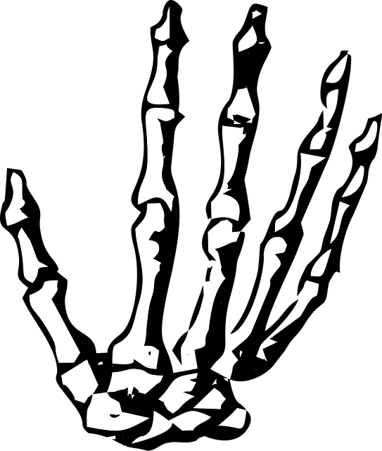 Digital Motion X-rays