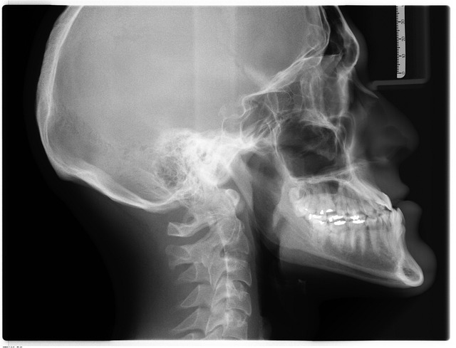 Digital Motion X-rays