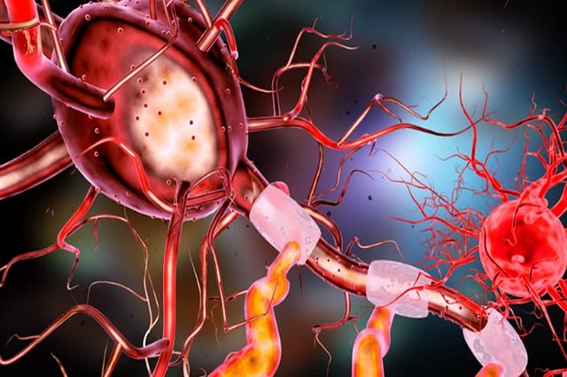 Pinched Nerves