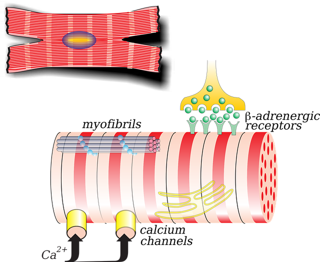 Pinched Nerves