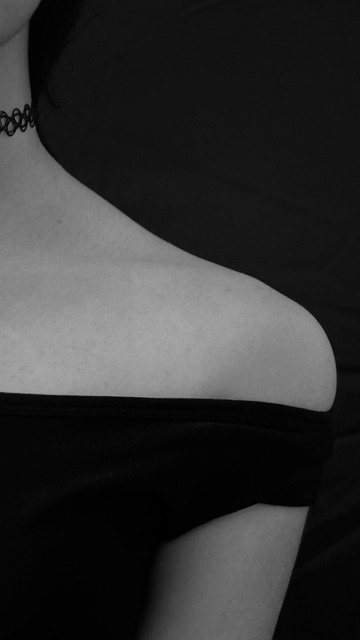 Chiropractic Care for Post-Accident Shoulder Impingement Relief